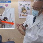 【生活】眼睛霧茫茫免驚！高雄榮總3D導航角膜內皮移植 七旬長輩重見光明